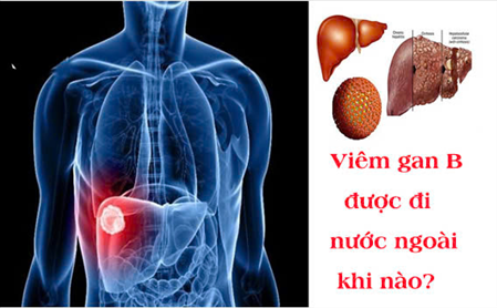 BỊ VIÊM GAN B CÓ ĐI CHÂU ÂU ĐƯỢC KHÔNG ?